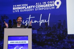 all-in-rhinoplasty-153