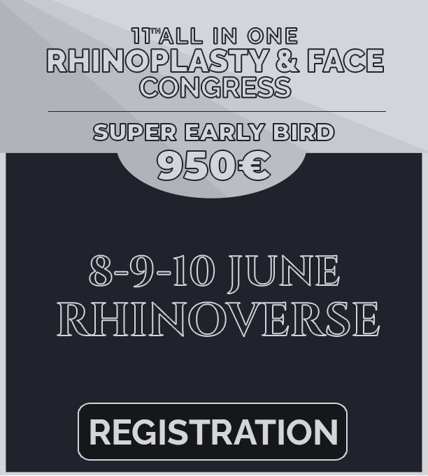 rhinoversee2